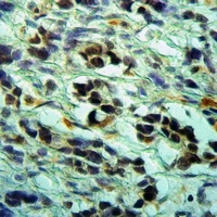 Anti-CLNS1A Antibody