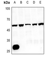 CMKLR1 Antibody