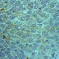 MRP2 Antibody