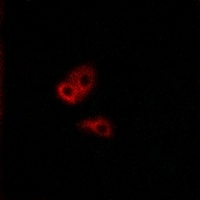 Anti-CNGA2 Antibody
