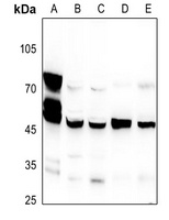 CNPase Rabbit Polyclonal Antibody