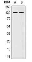 Collagen 1 alpha 2 Antibody