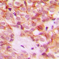 Collagen 1 alpha 2 Antibody