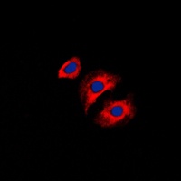 Collagen III antibody