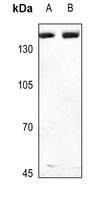 Collagen 3 alpha 1 Antibody