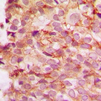 Anti-Collagen 4 alpha 1 Antibody
