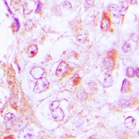 Anti-Collagen 6 alpha 2 Antibody