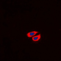 Anti-Collagen 6 alpha 2 Antibody