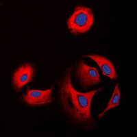 Collagen 11 alpha 1 Antibody