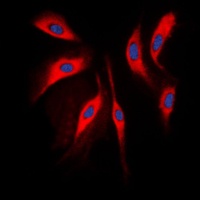 Anti-COMT Antibody