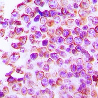 Anti-Claudin 4 Antibody