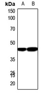 Carboxypeptidase N 1 Rabbit Polyclonal Antibody