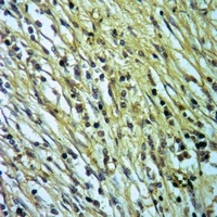 Carboxypeptidase N 1 Rabbit Polyclonal Antibody