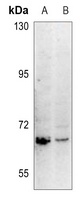 Carboxypeptidase N 2 Rabbit Polyclonal Antibody
