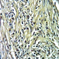 Anti-Carboxypeptidase N 2 Antibody