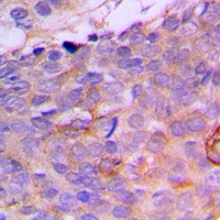 Anti-CRABP2 Antibody