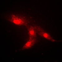 CRABP2 antibody