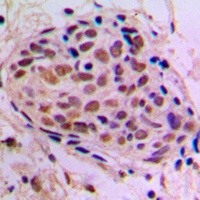 CREB Rabbit Polyclonal Antibody