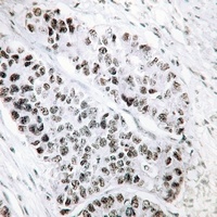 Anti-ATF2 (Phospho-S498) Antibody