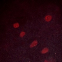 Anti-ATF2 (Phospho-S498) Antibody