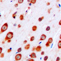 Anti-CRHR2 Antibody