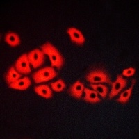 Anti-CRHR2 Antibody