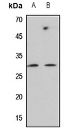 C-Reactive Protein Rabbit Polyclonal Antibody