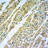 C-Reactive Protein Rabbit Polyclonal Antibody