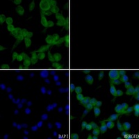 C-Reactive Protein Rabbit Polyclonal Antibody