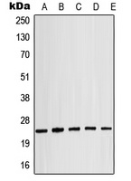 Alpha-crystallin B (Phospho-S19) Antibody