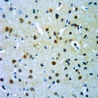 Alpha-crystallin B (Phospho-S19) Antibody