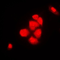 Anti-XPO2 Antibody
