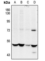 CSK (Phospho-S364) Antibody