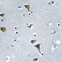 CSK (Phospho-S364) Antibody