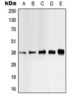 CK1 alpha (Phospho-Y321) Antibody