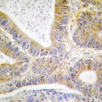 CK1 alpha (Phospho-Y321) Antibody