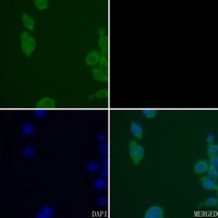 Anti-CK1 delta Antibody