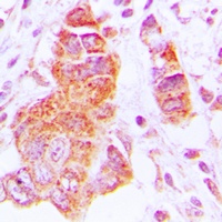 Anti-CK1 epsilon Antibody