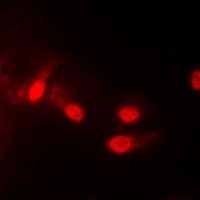 Anti-CK1 epsilon Antibody
