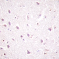 Anti-CK2 beta (Phospho-S209) Antibody
