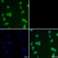 CSNK2B (phospho-S209) antibody