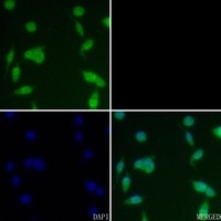 Anti-CK2 beta (Phospho-S209) Antibody