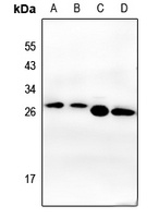 CK2 beta Antibody [KO/KD Validated]