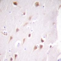 CK2 beta Antibody [KO/KD Validated]