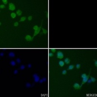 CK2 beta Antibody [KO/KD Validated]