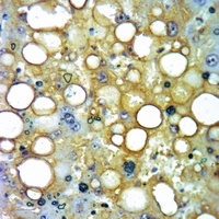 Anti-Neurocan Antibody