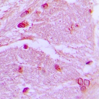 Anti-CSRP1 Antibody