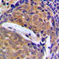 Anti-Cystatin B Antibody