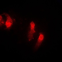 Anti-Cystatin B Antibody