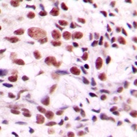 CSTF2 antibody